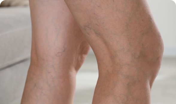 Visible blue veins